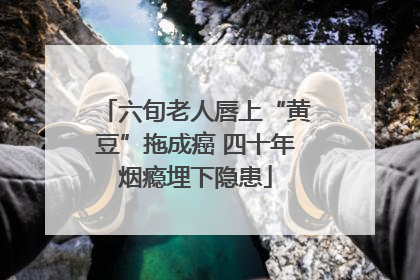 六旬老人唇上“黄豆”拖成癌 四十年烟瘾埋下隐患